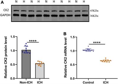 Casein kinase 2 attenuates brain injury induced by intracerebral hemorrhage via regulation of NR2B phosphorylation